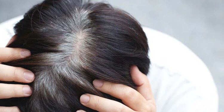 Prevent Premature Gray Hair