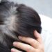 Prevent Premature Gray Hair
